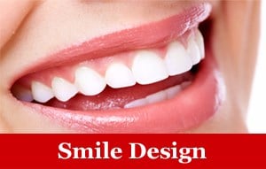 Smile Design