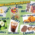 food to avoid during braces